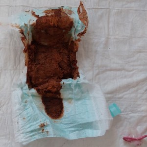 Hier die volle Windel und der Schnuller